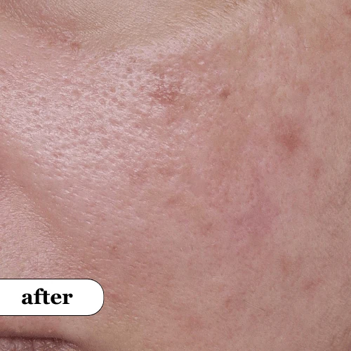 Avis authentiques de notre panel de test du Rice Duo